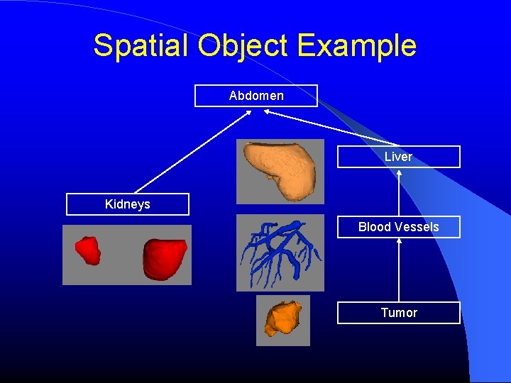 Spatial Object Example Abdomen Liver Kidneys Blood Vessels Tumor 