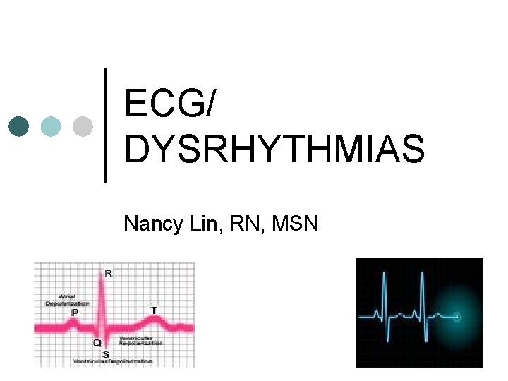 ECG/ DYSRHYTHMIAS Nancy Lin, RN, MSN 