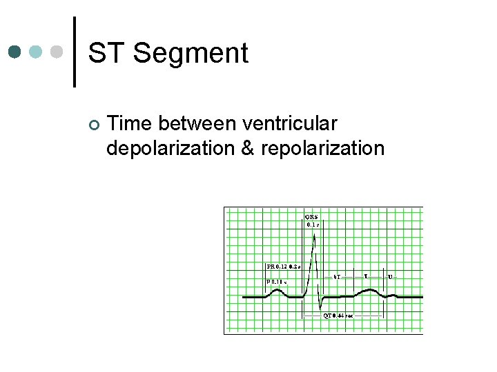 ST Segment ¢ Time between ventricular depolarization & repolarization 