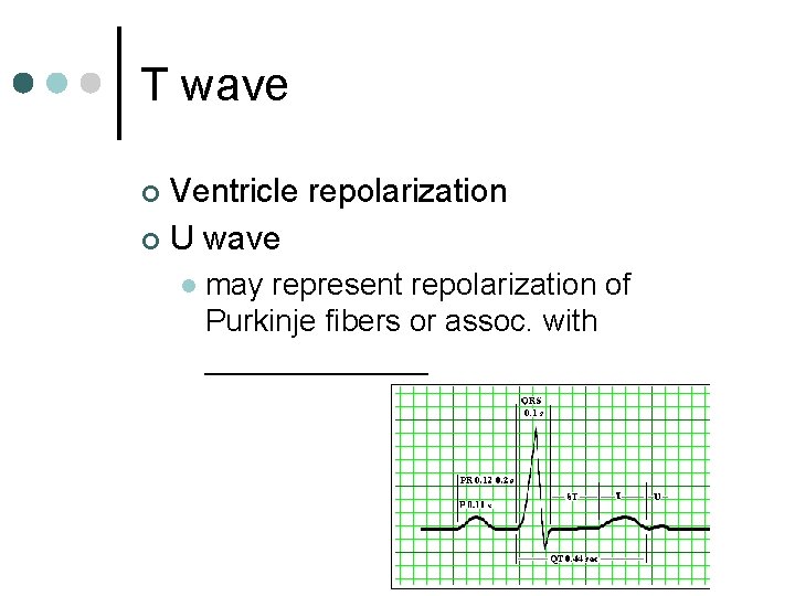 T wave Ventricle repolarization ¢ U wave ¢ l may represent repolarization of Purkinje