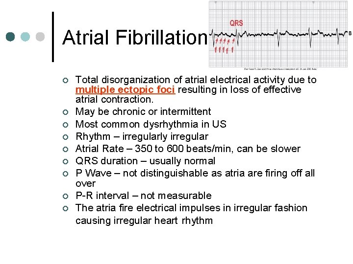 Atrial Fibrillation ¢ ¢ ¢ ¢ ¢ Total disorganization of atrial electrical activity due
