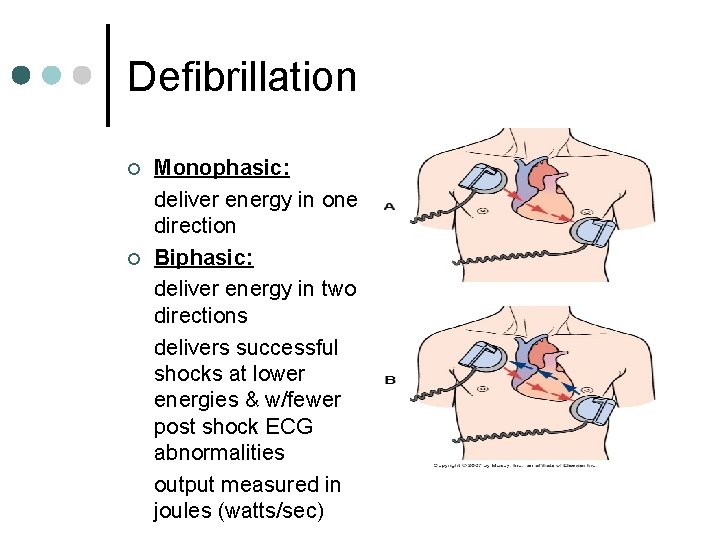 Defibrillation ¢ ¢ Monophasic: deliver energy in one direction Biphasic: deliver energy in two