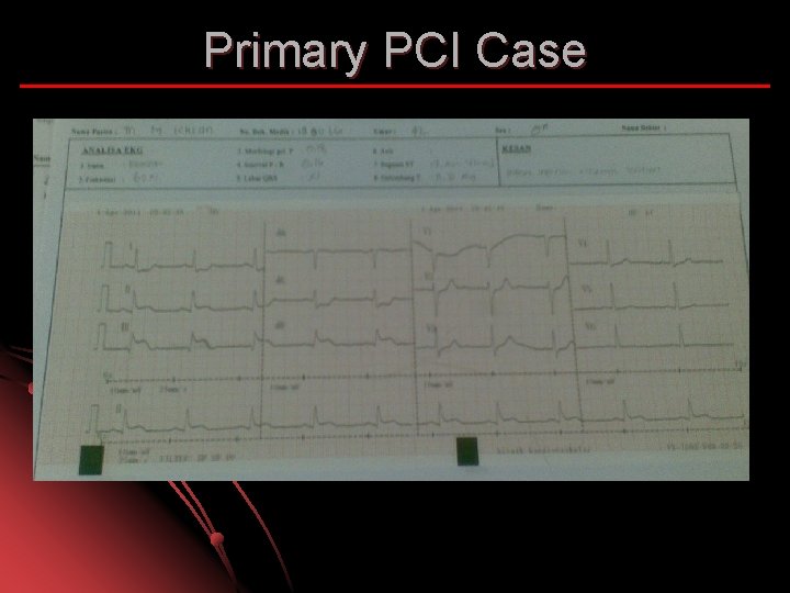 Primary PCI Case 