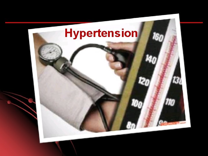 Hypertension 