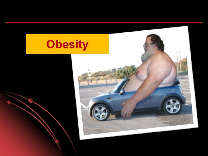 Obesity 