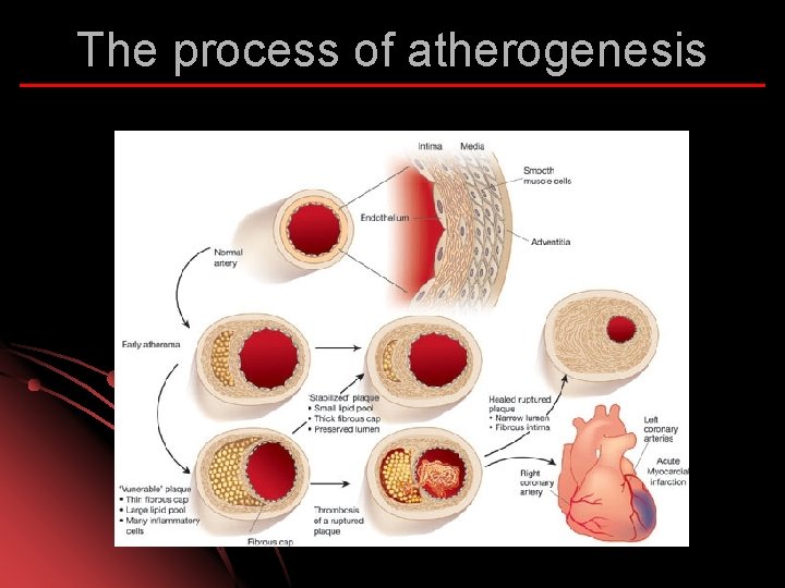 The process of atherogenesis 