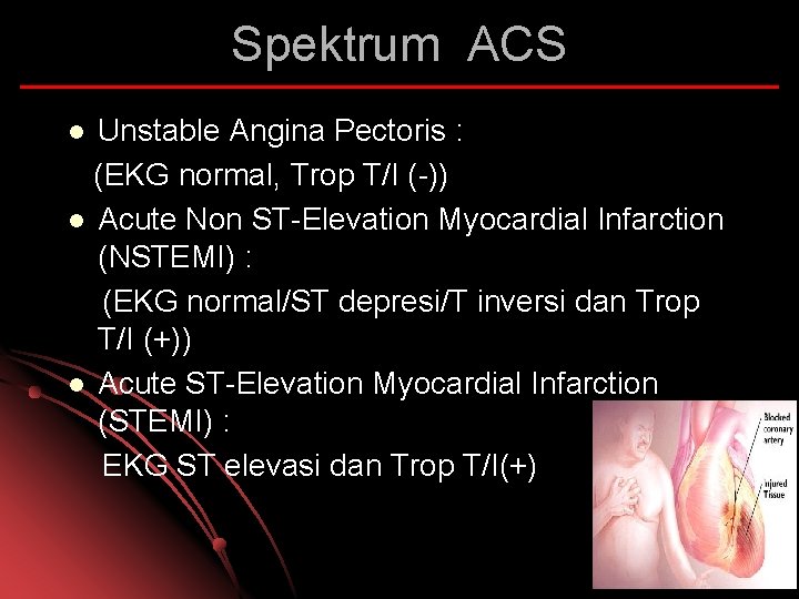 Spektrum ACS Unstable Angina Pectoris : (EKG normal, Trop T/I (-)) l Acute Non