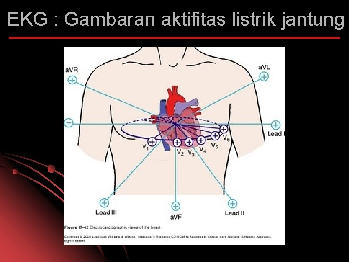 EKG : Gambaran aktifitas listrik jantung 