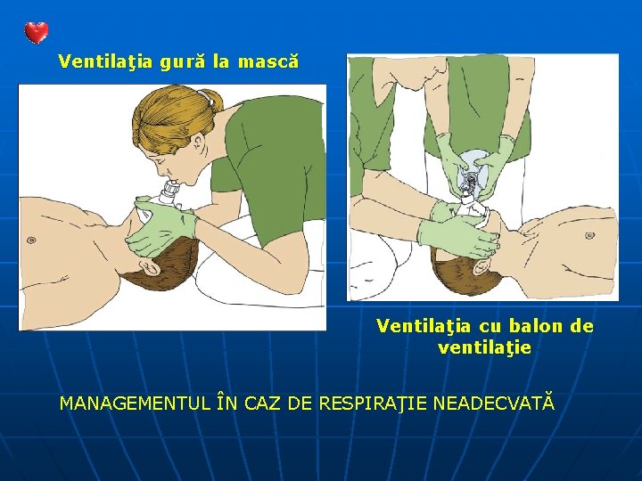 Ventilaţia gură la mască Ventilaţia cu balon de ventilaţie MANAGEMENTUL ÎN CAZ DE RESPIRAŢIE