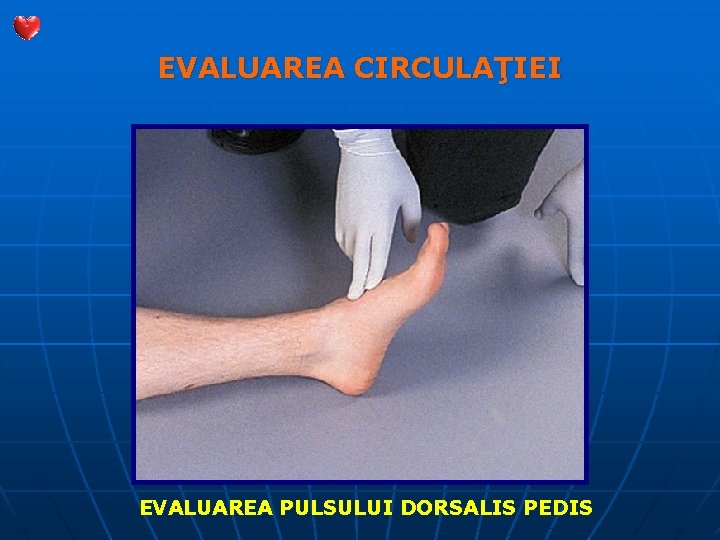 EVALUAREA CIRCULAŢIEI EVALUAREA PULSULUI DORSALIS PEDIS 