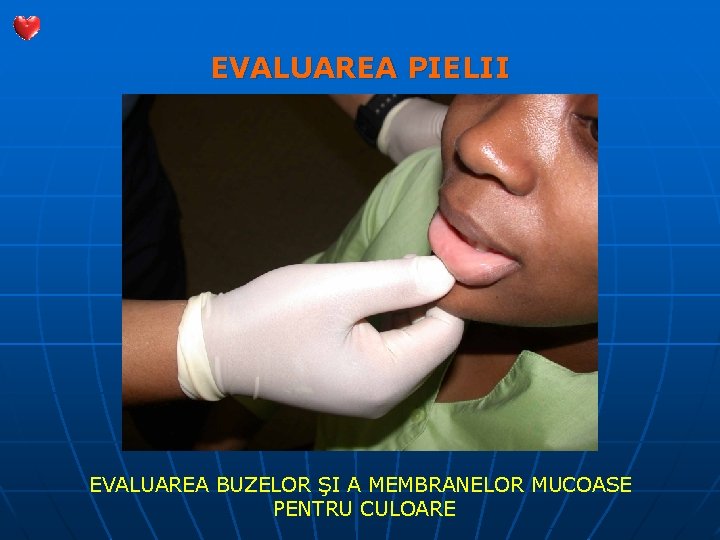 EVALUAREA PIELII EVALUAREA BUZELOR ŞI A MEMBRANELOR MUCOASE PENTRU CULOARE 