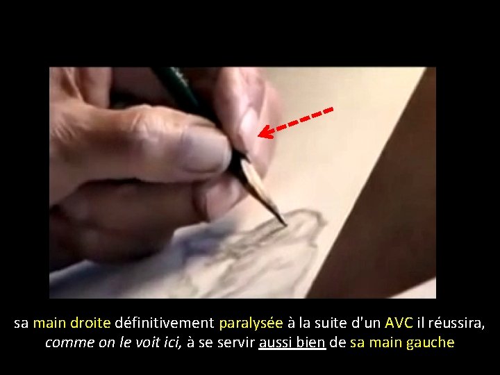 sa main droite définitivement paralysée à la suite d'un AVC il réussira, comme on