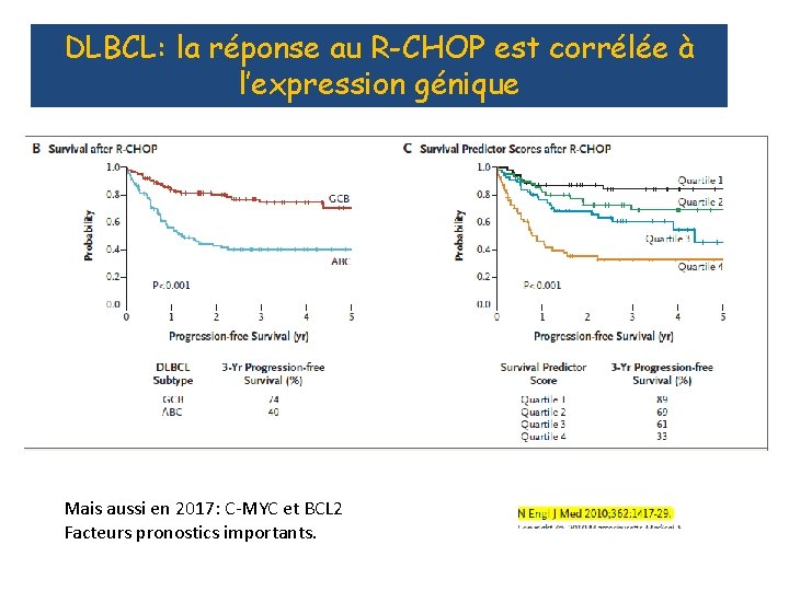 DLBCL: la réponse au R-CHOP est corrélée à l’expression génique Mais aussi en 2017:
