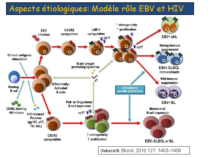 Aspects étiologiques: Modèle rôle EBV et HIV Dolcetti R. Blood. 2016: 127: 1403– 1409.