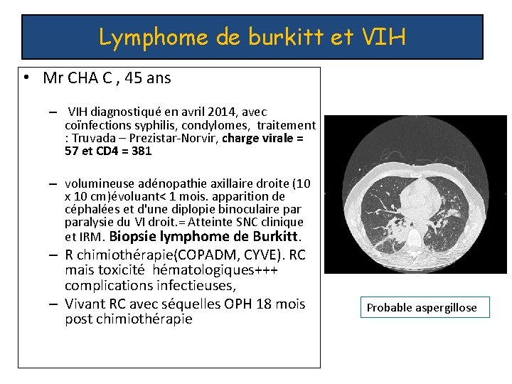 Lymphome de burkitt et VIH • Mr CHA C , 45 ans – VIH