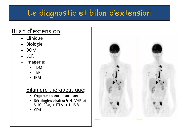 Le diagnostic et bilan d’extension Bilan d’extension: – – – Clinique Biologie BOM LCR