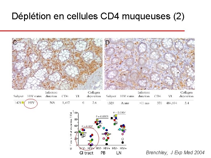 Déplétion en cellules CD 4 muqueuses (2) Brenchley, J Exp Med 2004 