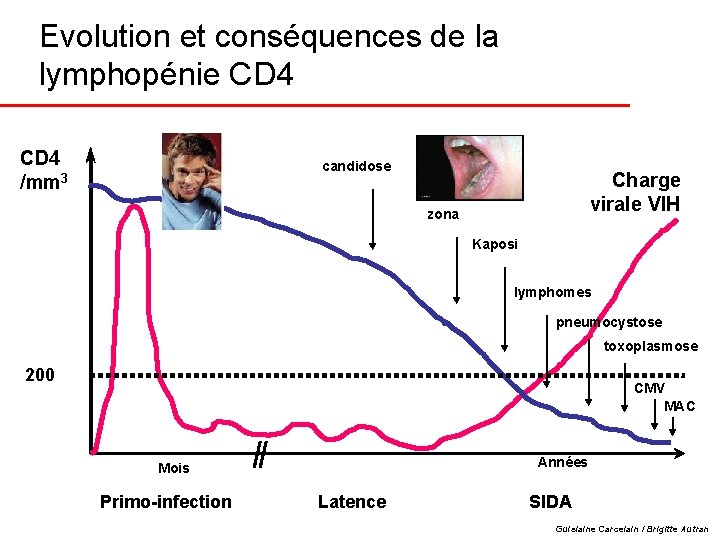 Evolution et conséquences de la lymphopénie CD 4 /mm 3 candidose Charge virale VIH
