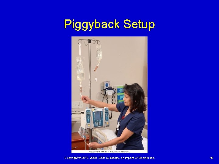 Piggyback Setup Copyright © 2013, 2009, 2005 by Mosby, an imprint of Elsevier Inc.