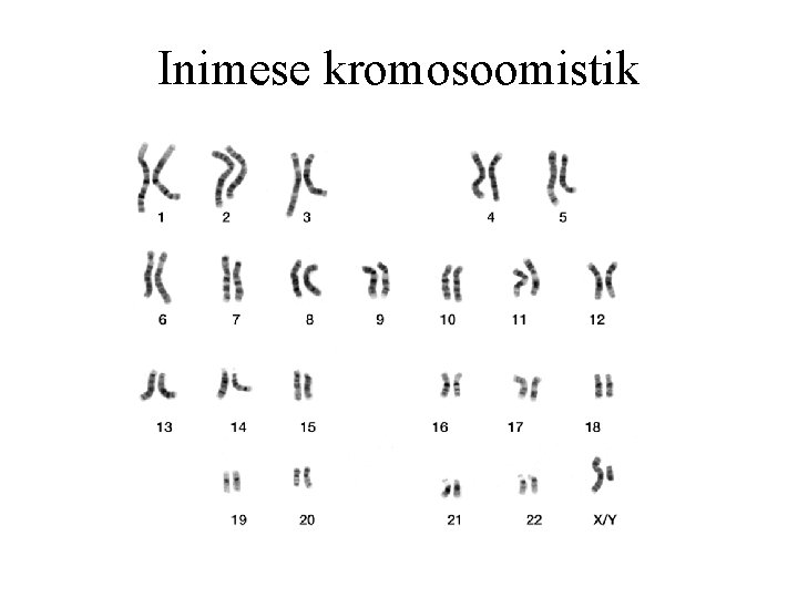 Inimese kromosoomistik 