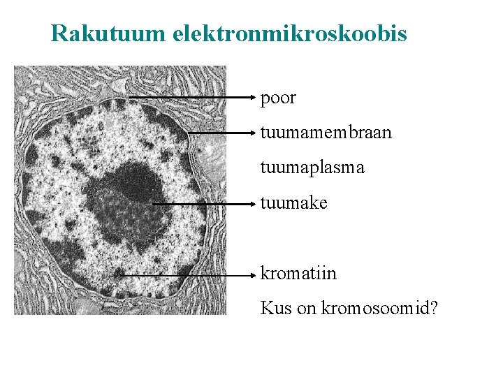 Rakutuum elektronmikroskoobis poor tuumamembraan tuumaplasma tuumake kromatiin Kus on kromosoomid? 