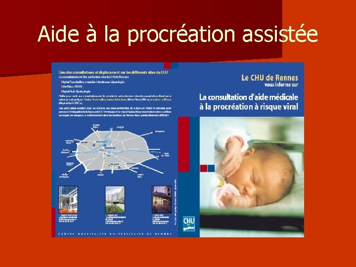 Aide à la procréation assistée 