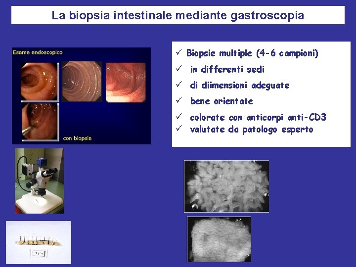 La biopsia intestinale mediante gastroscopia ü Biopsie multiple (4 -6 campioni) ü in differenti