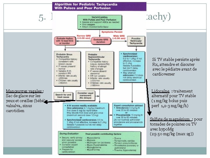 5. Les arythmies (brady/tachy) Si TV stable persiste après Rx, attendre et discuter avec