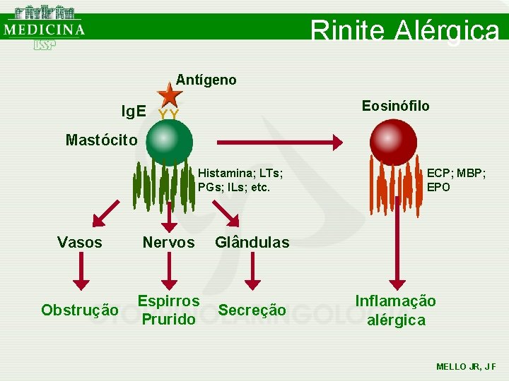 Rinite Alérgica Antígeno Eosinófilo Ig. E Y Y Mastócito Histamina; LTs; PGs; ILs; etc. Rinite Alérgica Antígeno Eosinófilo Ig. E Y Y Mastócito Histamina; LTs; PGs; ILs; etc.