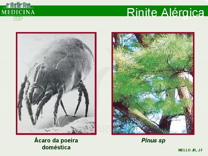 Rinite Alérgica Ácaro da poeira doméstica Pinus sp MELLO JR, J F Rinite Alérgica Ácaro da poeira doméstica Pinus sp MELLO JR, J F