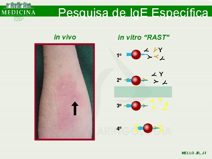 Pesquisa de Ig. E Específica in vitro “RAST” Y Y Y YYY 4 o Pesquisa de Ig. E Específica in vitro “RAST” Y Y Y YYY 4 o