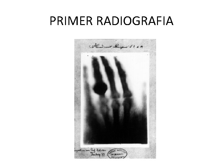 PRIMER RADIOGRAFIA 