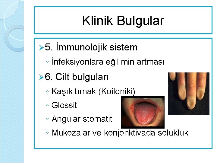 Klinik Bulgular Ø 5. İmmunolojik sistem ◦ İnfeksiyonlara eğilimin artması Ø 6. Cilt bulguları