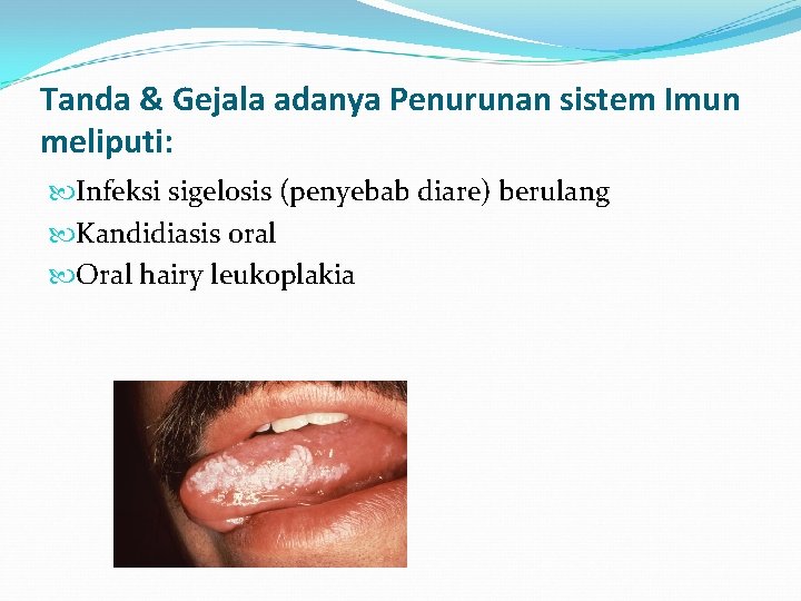 Tanda & Gejala adanya Penurunan sistem Imun meliputi: Infeksi sigelosis (penyebab diare) berulang Kandidiasis