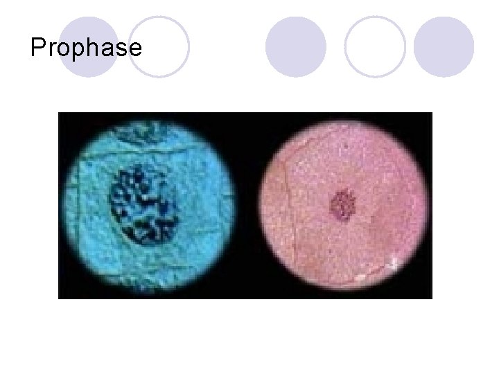 Prophase 