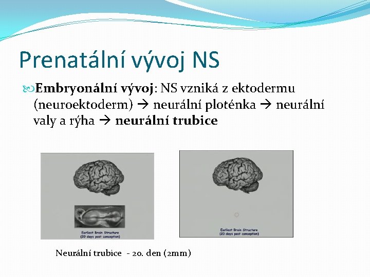 Prenatální vývoj NS Embryonální vývoj: NS vzniká z ektodermu (neuroektoderm) neurální ploténka neurální valy