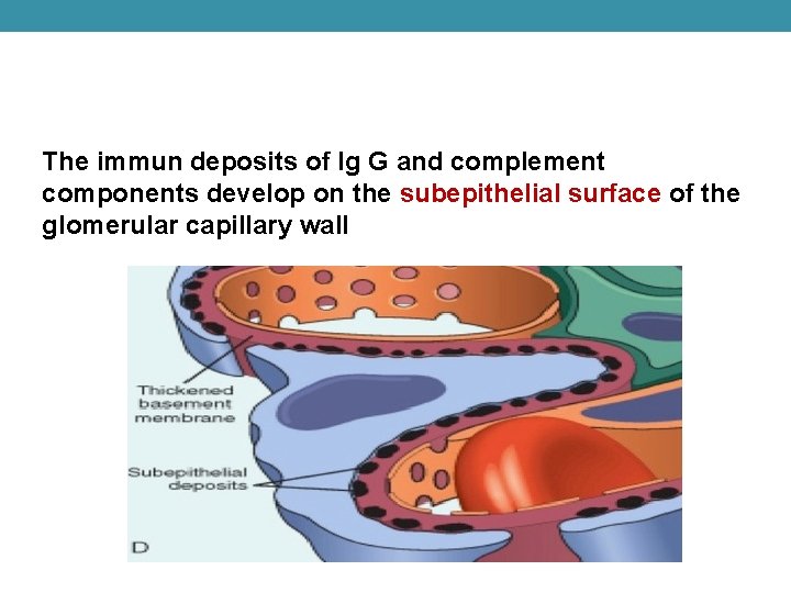 The immun deposits of Ig G and complement components develop on the subepithelial surface