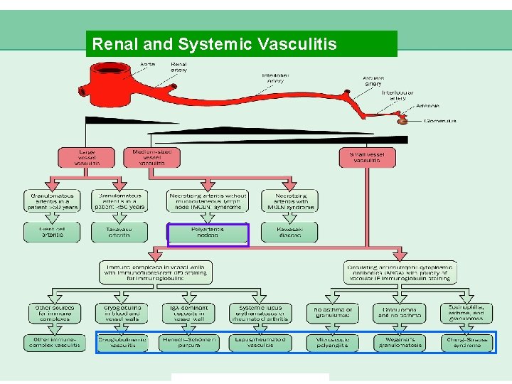 Renal and Systemic Vasculitis 