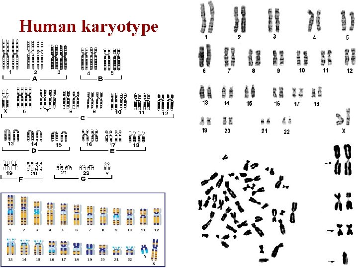 Human karyotype 54 