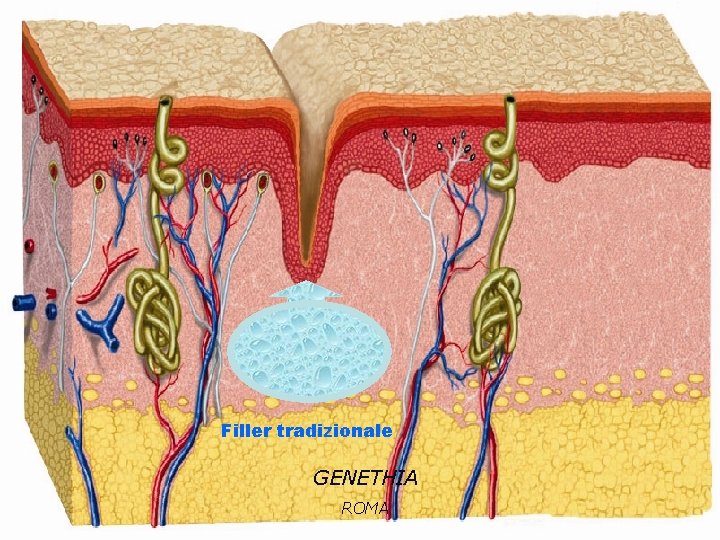 Filler tradizionale GENETHIA ROMA 