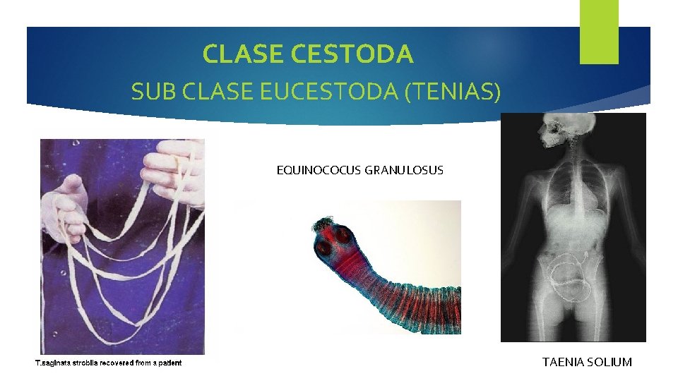 CLASE CESTODA SUB CLASE EUCESTODA (TENIAS) EQUINOCOCUS GRANULOSUS TAENIA SAGINATA TAENIA SOLIUM 
