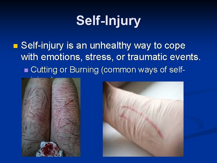 Self-Injury n Self-injury is an unhealthy way to cope with emotions, stress, or traumatic