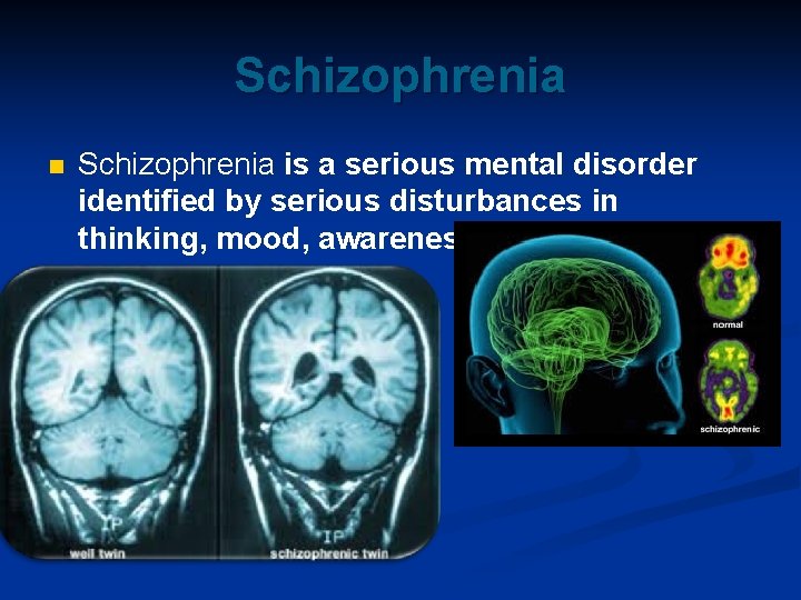 Schizophrenia n Schizophrenia is a serious mental disorder identified by serious disturbances in thinking,