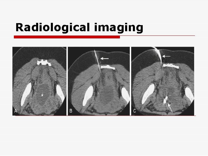 Radiological imaging Radiological imaging