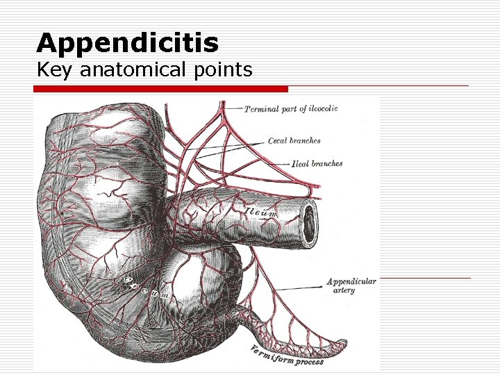 Appendicitis Key anatomical points Appendicitis Key anatomical points