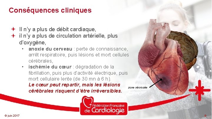 Conséquences cliniques Il n’y a plus de débit cardiaque, il n’y a plus de