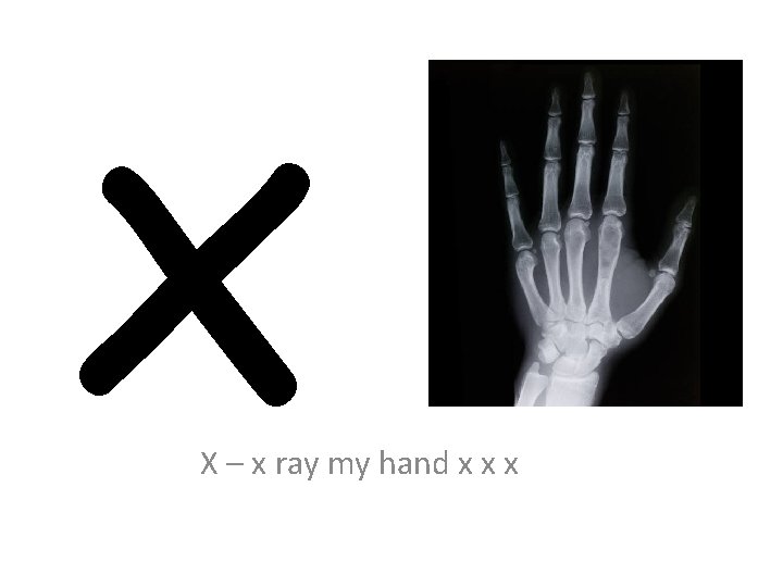 x X – x ray my hand x x x 