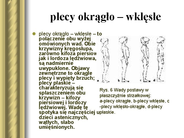 plecy okrągło – wklęsłe l plecy okrągło – wklęsłe – to połączenie obu wyżej