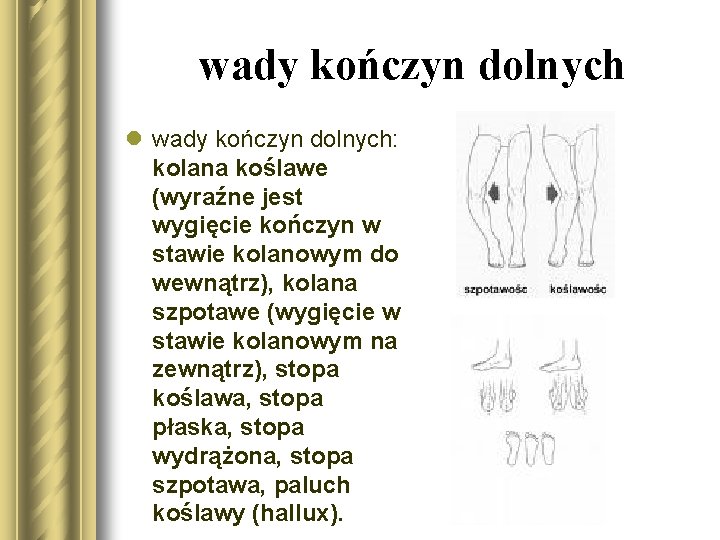 wady kończyn dolnych l wady kończyn dolnych: kolana koślawe (wyraźne jest wygięcie kończyn w