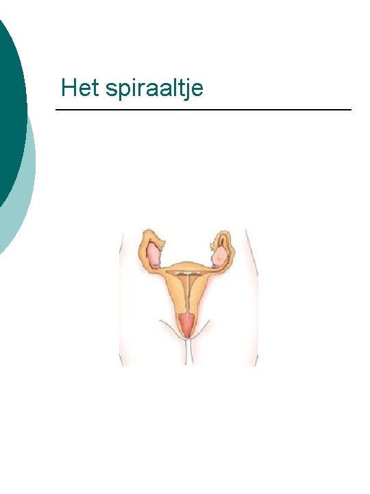 Het spiraaltje 